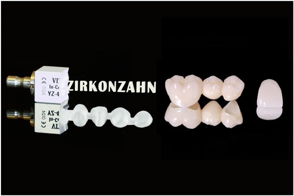 Zahnarzt München Zirkonkrone, Zirkonbrücke, Zahnersatz aus Zirkon, Glaskeramik, metallfreier Zahnersatz, allergiefreier Zahnersatz